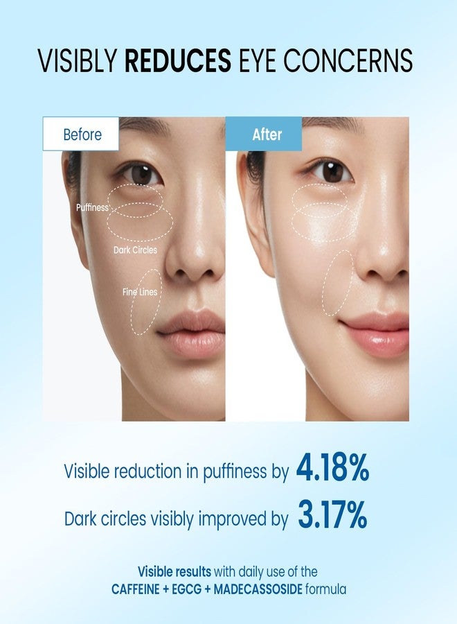 Dongyu Eye Cream for Dark Circles: Korean Caffeine Eye Cream Daily Morning Skincare - Puffy Eyes Treatment for Beauty Enthusiasts (Blue) - Image 2
